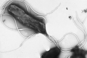 H. pylori