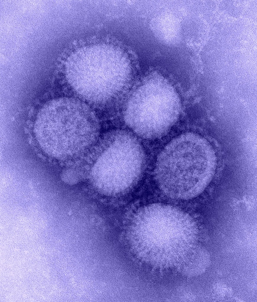 H1N1 Virus