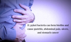 H. pylori bacteria can form biofilm and cause gastritis, abdominal pain, ulcers and stomach cancer