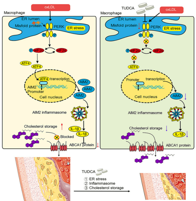 Atherosclerosis-TUDCA and-ER-Stress