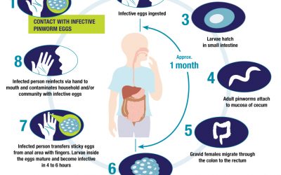 A Six Part, Comprehensive Approach, For Resistant or Stubborn Pinworm / Threadworm Infection