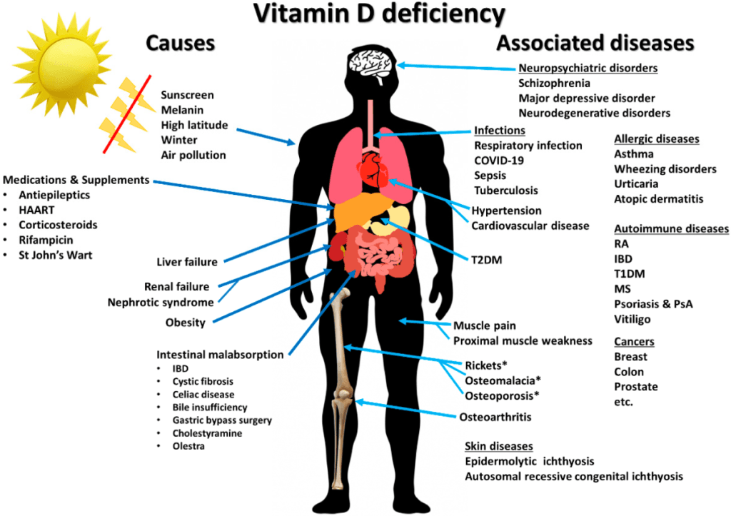 Vitamin D deficiency and associated diseases