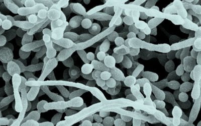 Biofilm Basics – What It Is and What Is Its Purpose