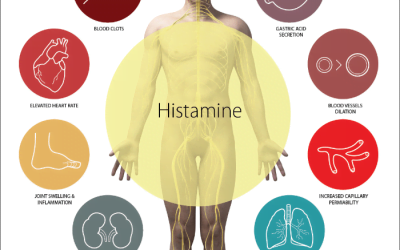 Mast Cell Activation Syndrome, IBS, Dysbiosis, SIBO